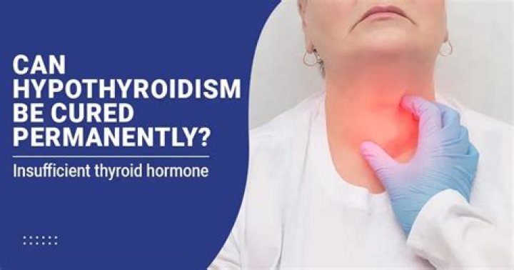 Can hypothyroidism be cured permanently?