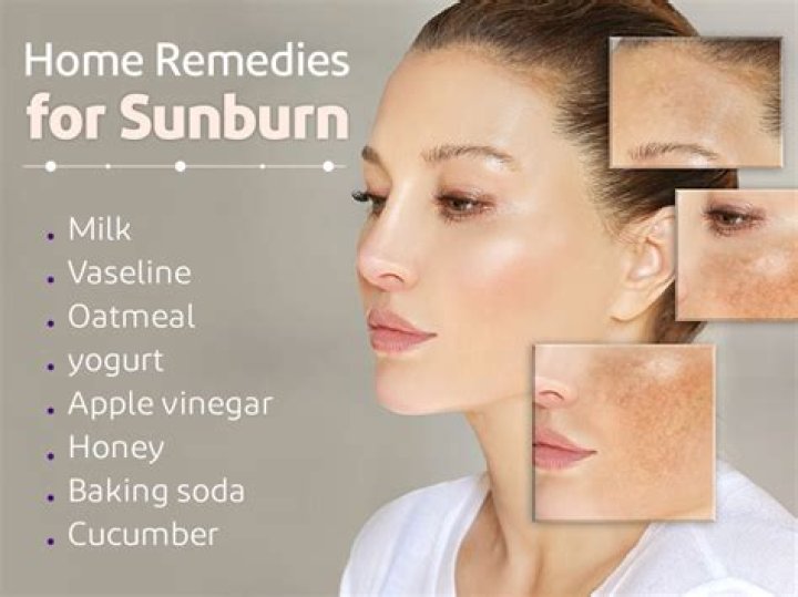 Can I use soap on sunburn?