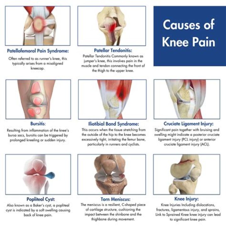 Can inactivity cause knee pain?
