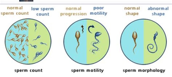 Can low sperm count be cured?