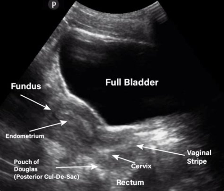 Can pelvic MRI be done during periods?