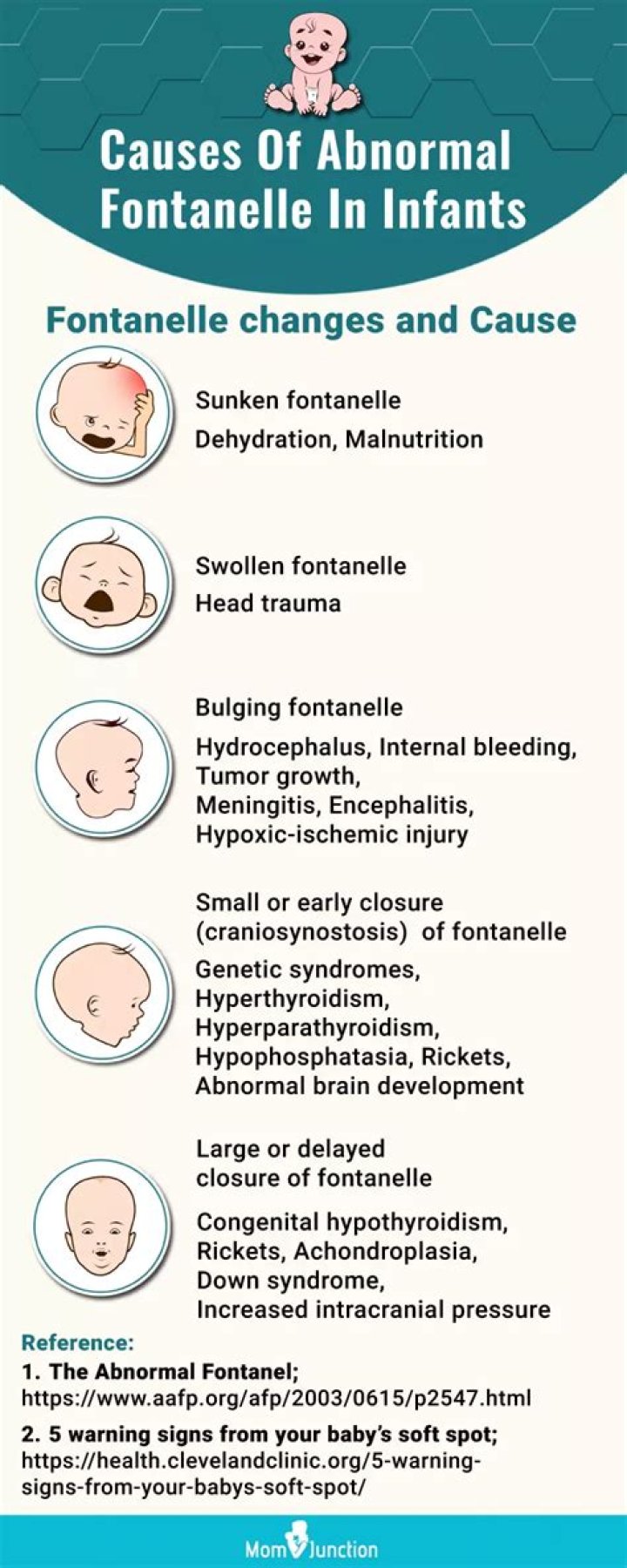 Can see fontanelle pulsating? | ContextResponse.com