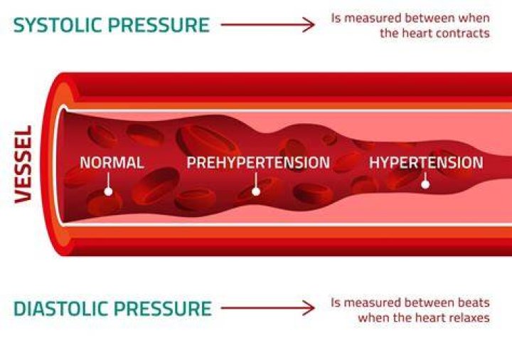 Can stress cause high systolic blood pressure?