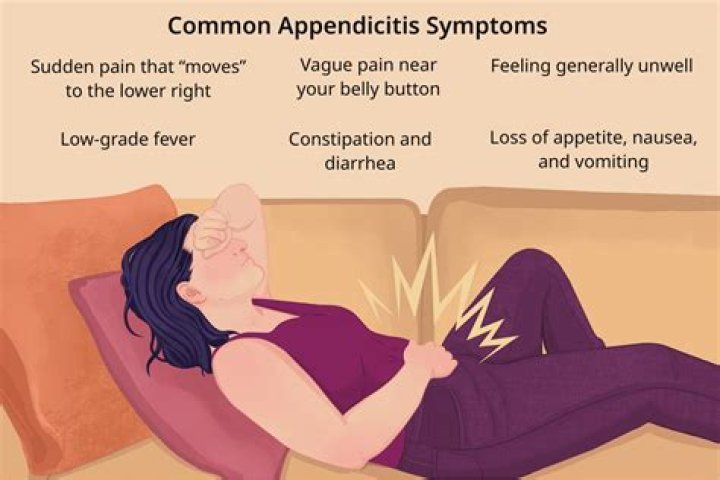Can symptoms of appendicitis go away?