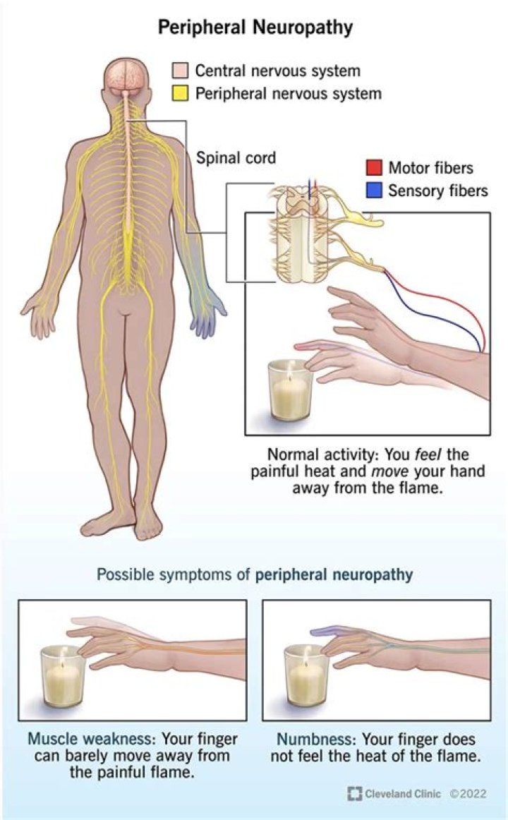 Can too much b12 cause peripheral neuropathy?