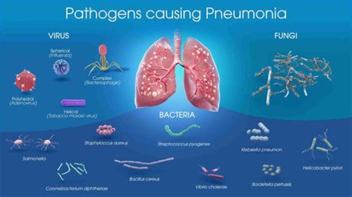 Can you catch pneumonia from someone who has it?
