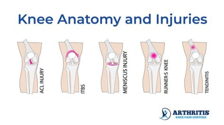 Can you get a cold in your knee?