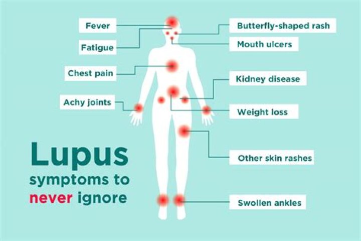 Can you have lupus and psoriasis?