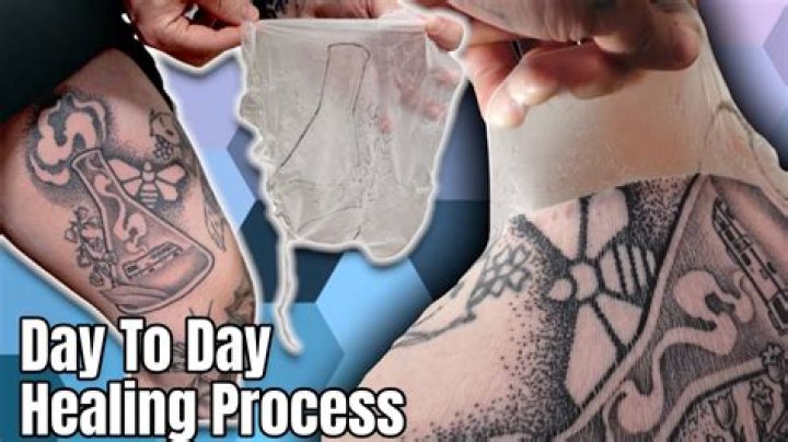 Can you overlap Saniderm? | ContextResponse.com
