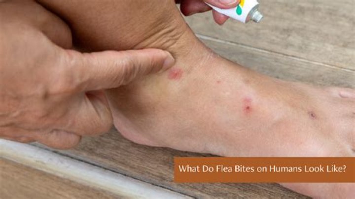 Do bird fleas bite humans?