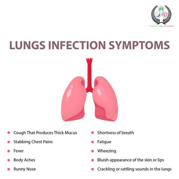 Do cats need antibiotics for upper respiratory infection?