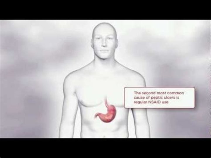 Does ibuprofen upset your stomach?