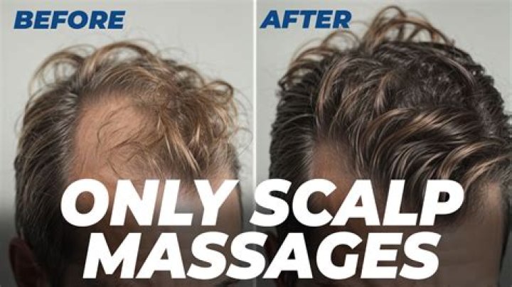 Does scalp massage prevent hair loss?