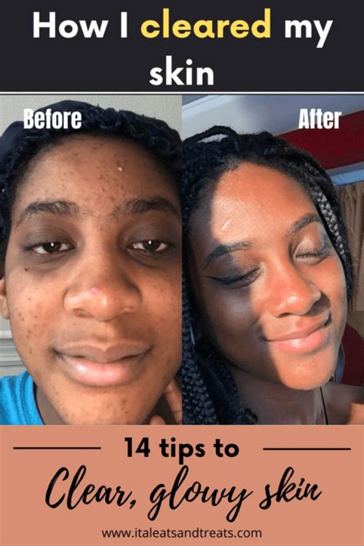 How can I make my skin clear and smooth home remedies?