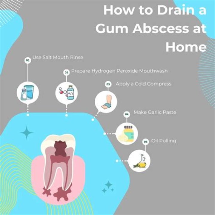 How do you get rid of an abscess on your gum?