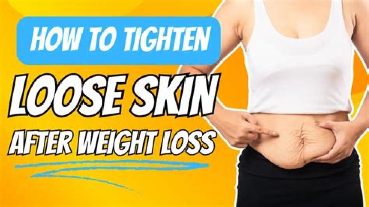 How do you get rid of extra skin after losing weight?