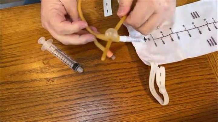 How do you remove a catheter from a female?