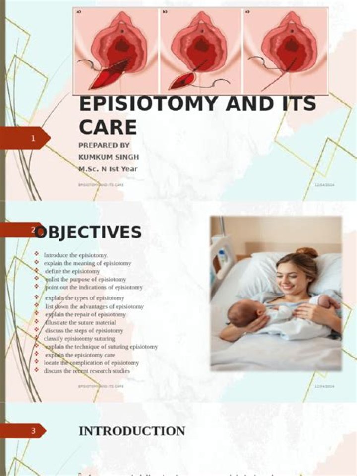 How do you take care of episiotomy stitches?