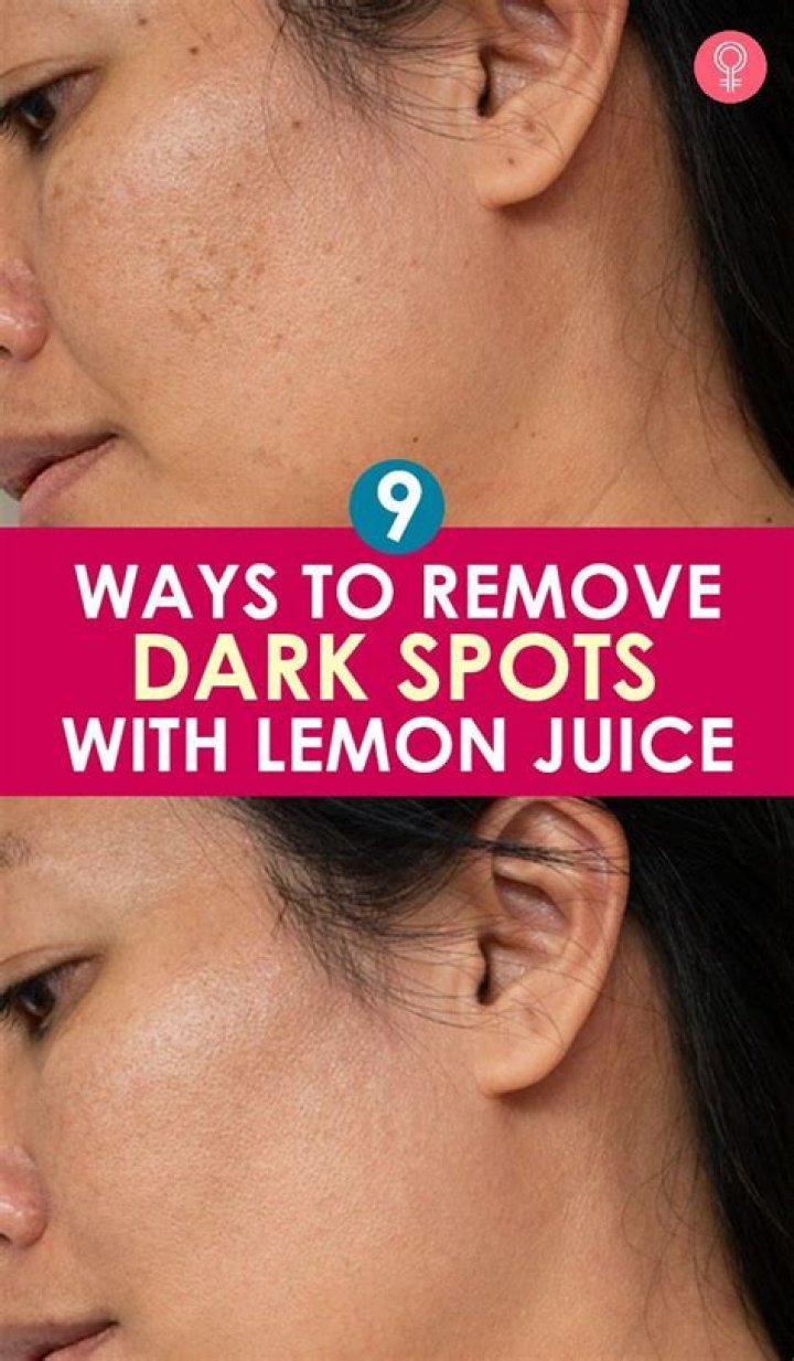 How do you use lemon for dark spots?