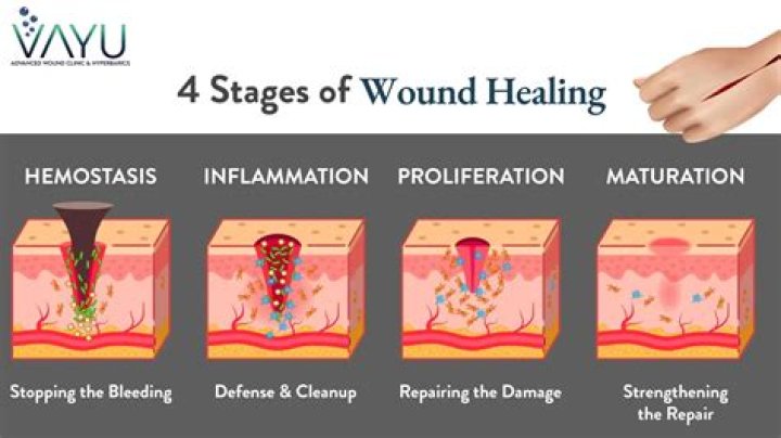 How long do bullet wounds take to heal?
