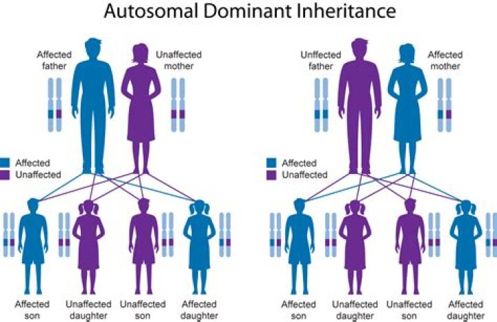 Is dwarfism autosomal dominant or recessive?