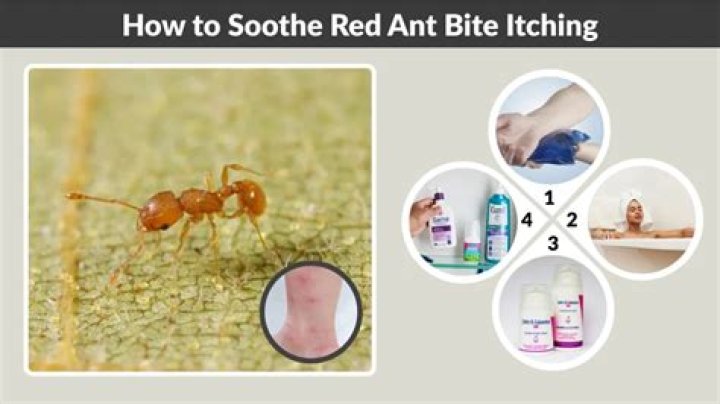 Should you pop red ant bites?