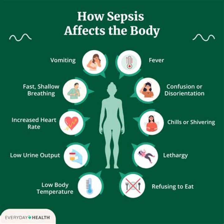 What are the after effects of sepsis?