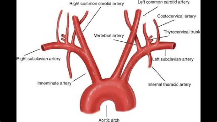 What are the branches of the aorta?
