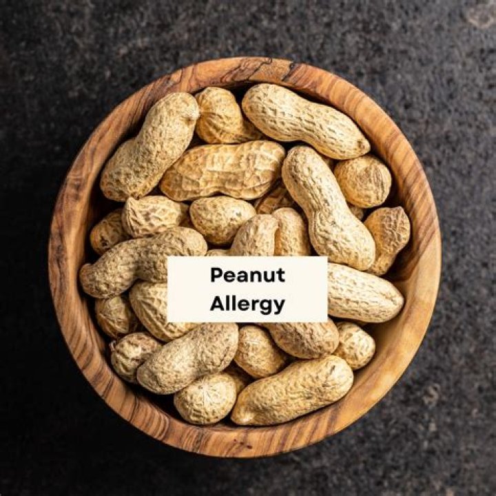 What are the levels of peanut allergy?