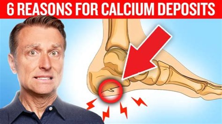 What causes calcium buildup on salt cell?