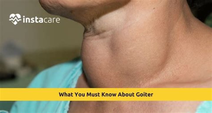 What causes cretinism and goiter?