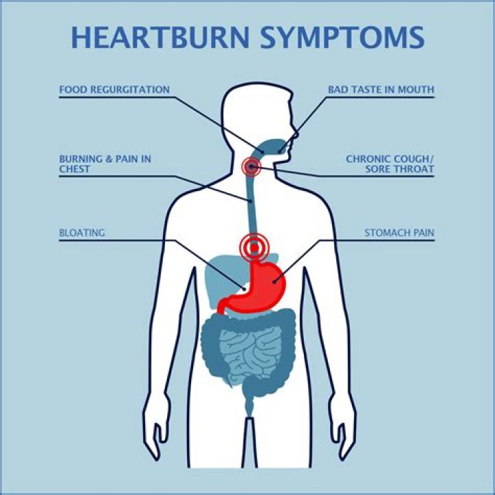 What causes heartburn after drinking alcohol?