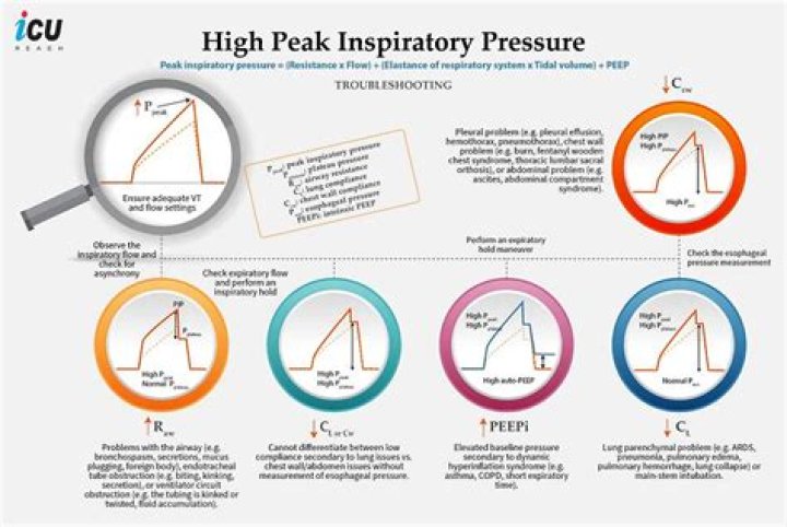 What causes high peak inspiratory pressure?