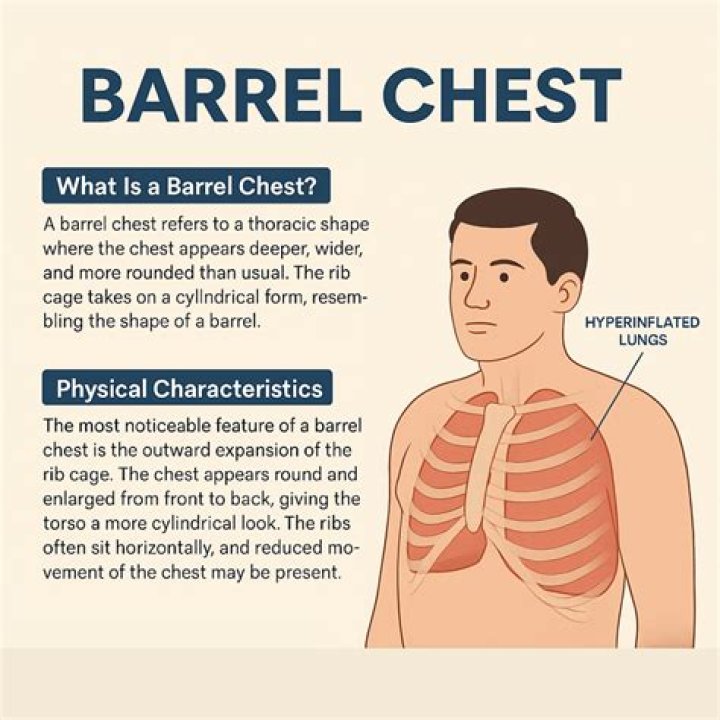What does a barrel shaped chest look like?