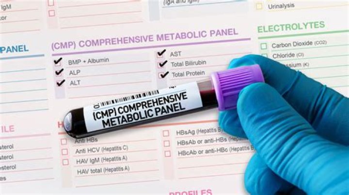 What does a complete metabolic panel test for?