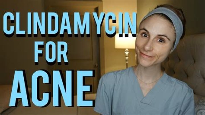 What does Clindamycin Gel do for acne?