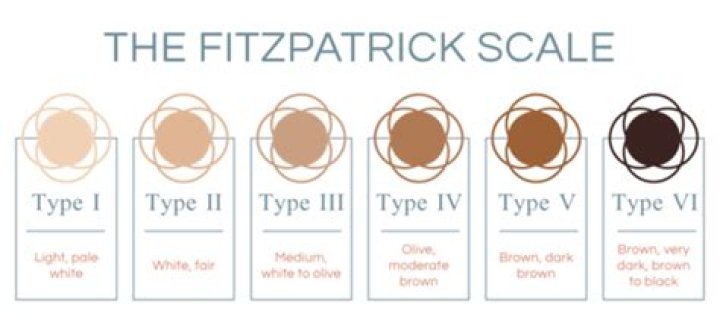 What does Fitz mean in Irish?