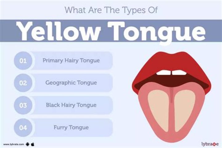 What does it mean if you have a yellow tongue?