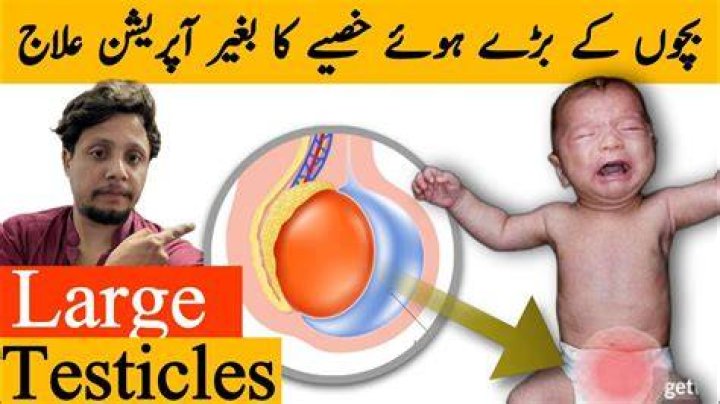 What happens if my baby only has one testicle?