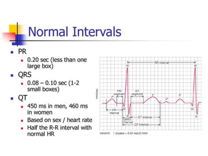 What is a normal RR interval?
