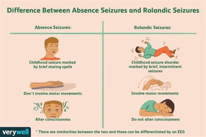 What is a Rolandic seizure?