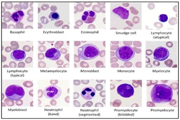 What is Gran% in blood test?