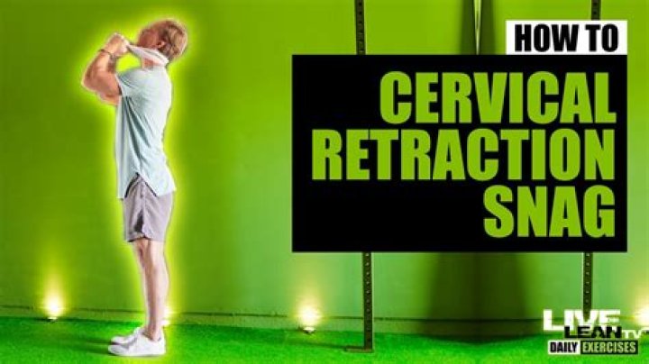 What is snag in physical therapy?