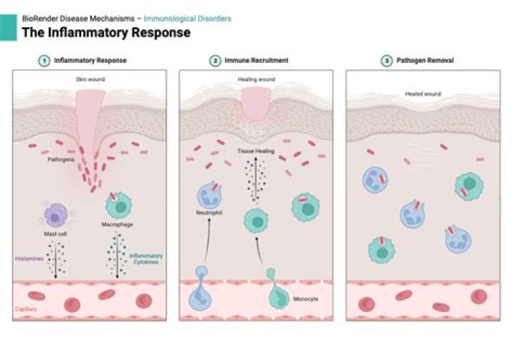 What is the body's inflammatory response?
