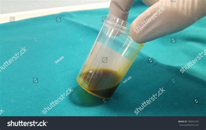 What is the color of bile?