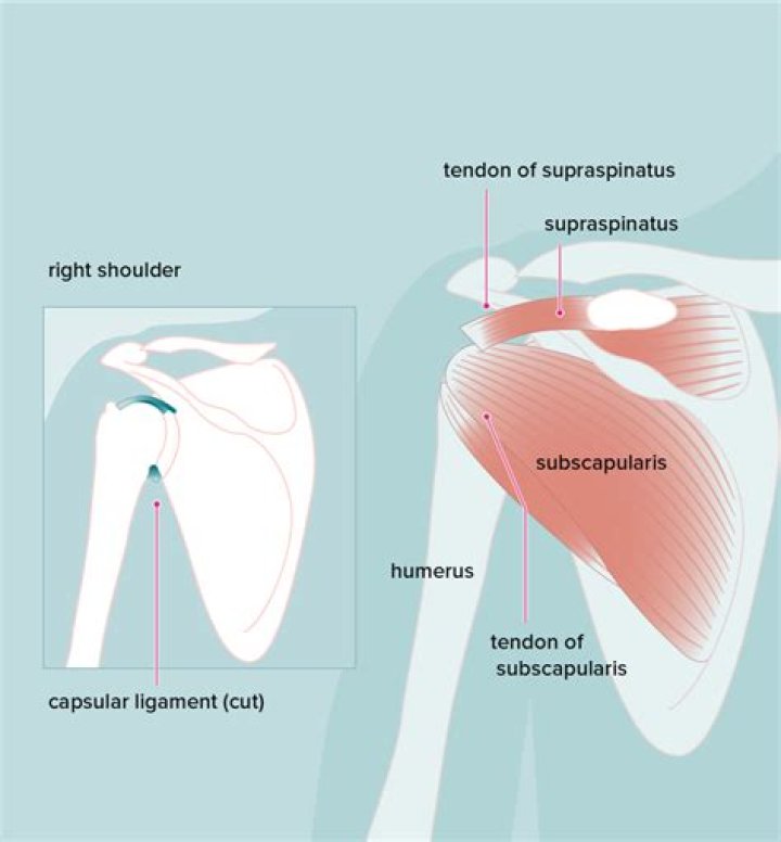 What is the definition of Acromial?