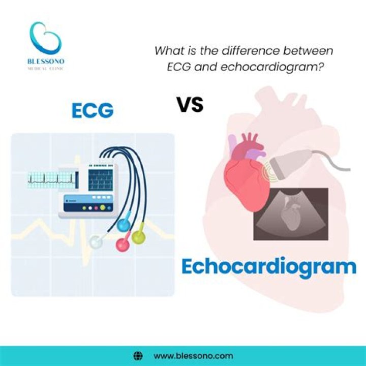 What is the difference between an ECG and EKG?