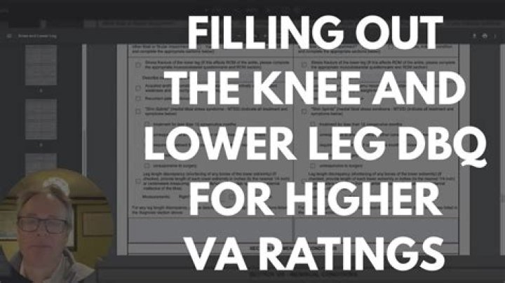 What is the highest VA rating for knees?