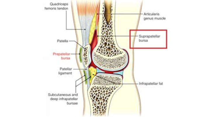 What is the Suprapatellar recess?