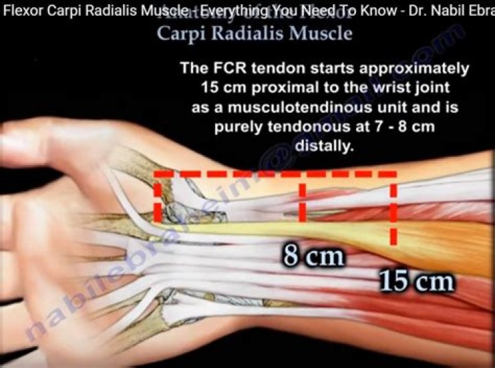 Where is the FCR tendon?
